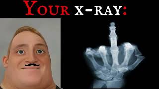 Mr Incredible Becoming Uncanny(Your X - RAY)