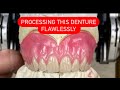 PROCESSING AN UPPER DENTURE WITHOUT MISTAKES