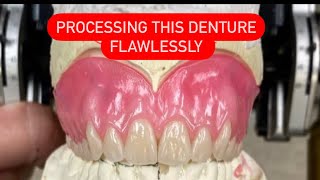 PROCESSING AN UPPER DENTURE WITHOUT MISTAKES