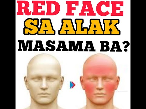 Video: 3 Mga Paraan upang Masabi Kung Mayroon kang mga Allergies sa Alak