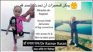 𝐓𝐢𝐛𝐢𝐚𝐥 𝐇𝐞𝐦𝐢𝐦𝐞𝐥𝐢𝐚𝐏𝐨𝐩𝐥𝐢𝐭𝐞𝐚𝐥 𝐏𝐭𝐞𝐫𝐲𝐠𝐢𝐮𝐦𝐀𝐫𝐭𝐡𝐫𝐨𝐠𝐫𝐲𝐩𝐨𝐬𝐢𝐬𝐃𝐫 𝐑𝐚𝐭𝐧𝐚𝐯 𝐑𝐚𝐭𝐚𝐧𝐃𝐞𝐟𝐨𝐫𝐦𝐢𝐭𝐲 𝐂𝐨𝐫𝐫𝐞𝐜𝐭𝐢𝐨𝐧