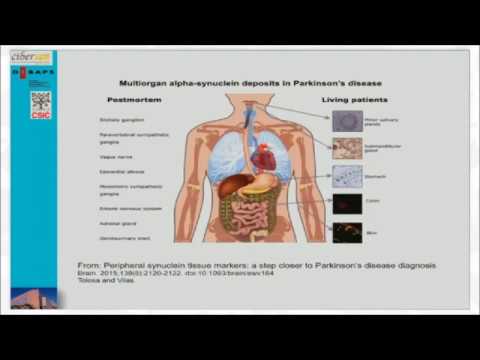 Avenços en el tractament de la malaltia de Parkinson