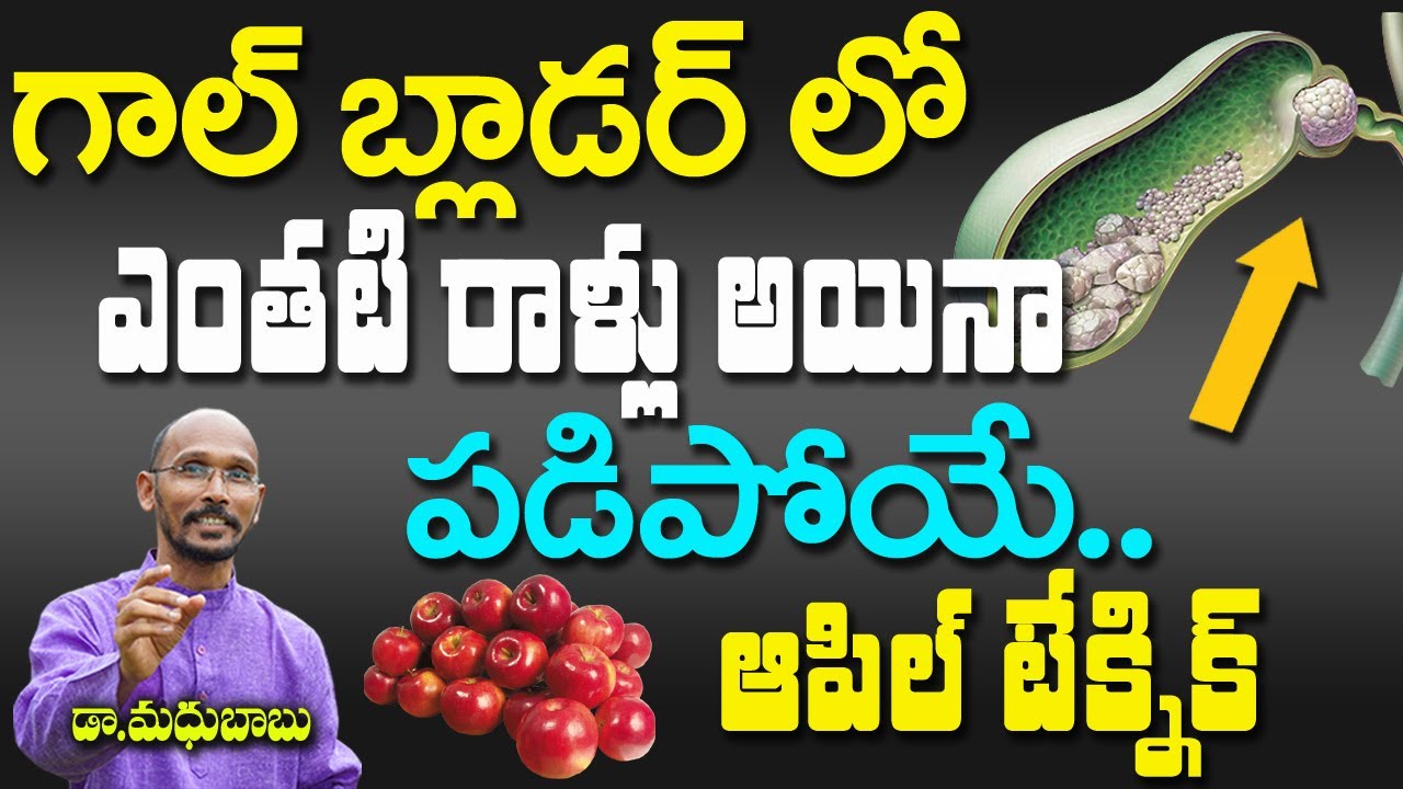 గాల్ బ్లాడర్ లో ఎంతటి రాళ్లు అయినా పడిపోయే ఆపిల్ టెక్నిక్ | Dr. Madhu Babu | Health Trends |