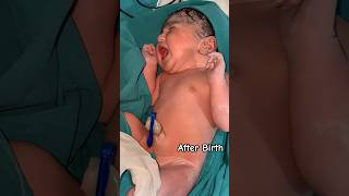 after Birth, the boy is trying to give his first cry 😢 #boyslife #hospitallife #nursingcare