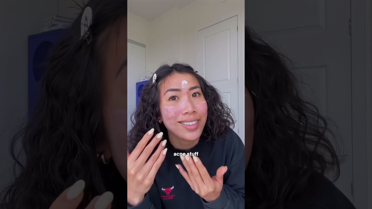 I’ve gained so much clarity and peace after I understood this logic behind my adult acne lol