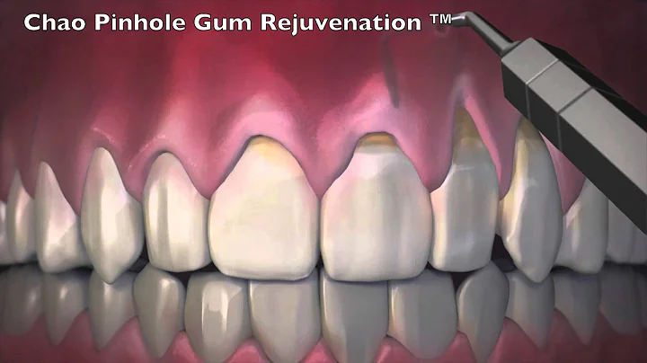 DC Dentist Dr. Yasmin Majid Shares Chao Pinhole Gu...