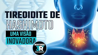 Tireoidite de Hashimoto: UMA VISÃO INOVADORA