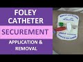 Stat Lock Securement Device Application and Removal Quiz
