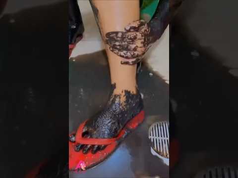 الكركم لتفتيح وتبييض الجسم      اكسبلور وصفات