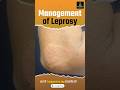 Leprosy Management: Treatment & Prevention 🩺