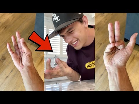 CAN YOUR HAND DO THIS?? 🤯 - #Shorts