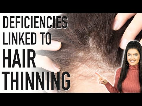 HAIR THINNING | 5 Nutrient Deficiencies Linked to Hair Loss (and how to fix it!)