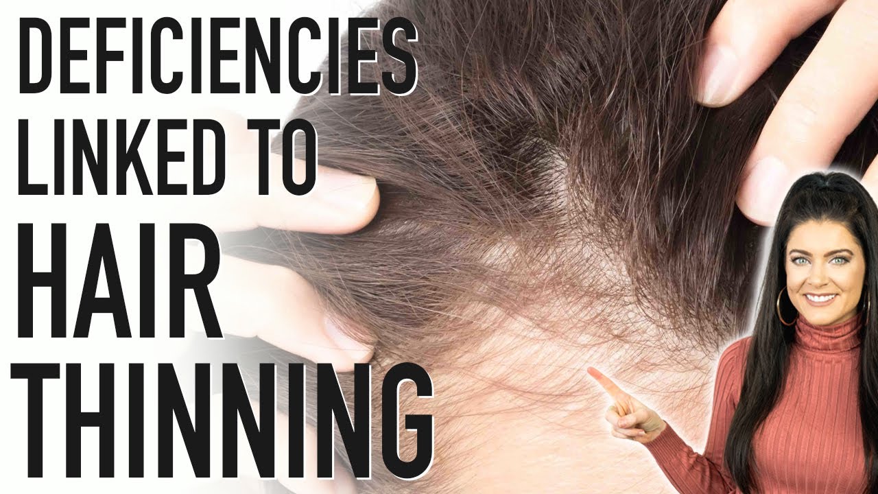 What Vitamin Deficiencies Can Cause Hair Loss 10 Possibilities