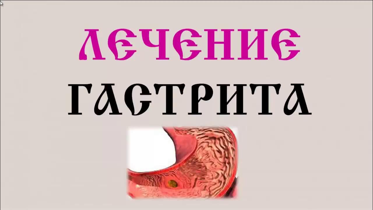 Как можно лечить гастрит. Профилактика острого гастрита.