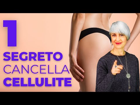 Video: Cellulite Al Seno: Cause, Trattamento, Sintomi E Altro