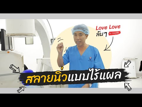 วีดีโอ: วิธีกำจัดนิ่วโดยไม่ต้องผ่าตัด