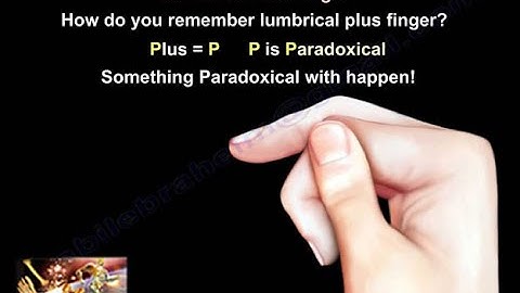 Lumbrical Plus Finger & Quadrigia - Everything You Need To Know - Dr. Nabil Ebraheim