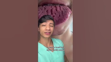 Sua Língua é assim também?? #shorts