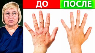 видео: Устали от аллергии? 2 МОЩНЫХ УПРАЖНЕНИЯ ОТ АЛЛЕРГИИ картинка: Устали от аллергии? 2 МОЩНЫХ УПРАЖНЕНИЯ ОТ АЛЛЕРГИИ