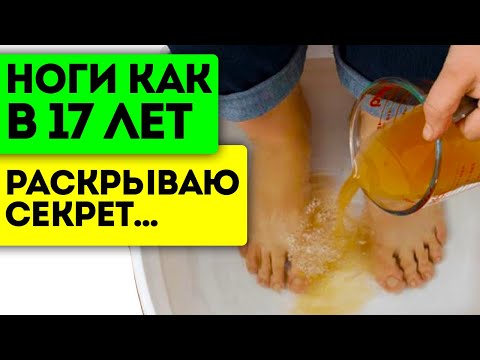 Только так спасёт ноги! Вот как я готовлю ванночку с яблочным уксусом и--