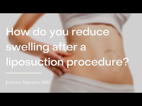 How do you reduce swelling after a liposuction procedure?