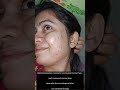 My skin transformation  viral shorts youtubeshorts acne acnetreatment