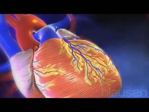 Vídeo: Roles De Neutrófilos En La Remodelación Ventricular Izquierda Después De Un Infarto De Miocardio