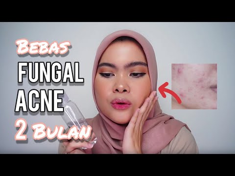 Skincare Routine: Jerawat Dan Fungal Acne