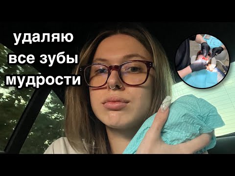 МОЙ ОПЫТ: УДАЛЕНИЕ ВСЕХ ЗУБОВ МУДРОСТИ ЗА РАЗ