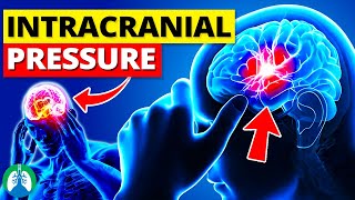 Intracranial Pressure (ICP) *Quick Explainer Video* 🧠