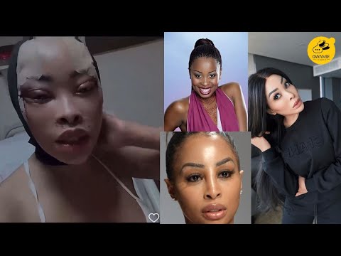 khanyi mbau skin lightening glutathione injections The Evolution Of Mbau's Face rihanna sandals Choose Your Bundle:1 Pack Glutathione Whitening Expert Scrub