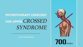 PHYSIOTHERAPY EXERCISES FOR UPPER CROSSED SYNDROME