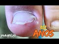 CUIDE DE SUAS CRIANÇAS #podologomaurelio #podiatry