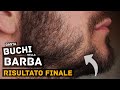 Buchi nella Barba, Copenhagen Grooming TEST FINALE | Parte 4
