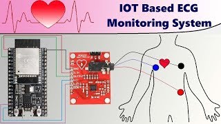 IoT Based ECG Monitoring with AD8232 ECG Sensor & ESP32