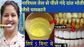 Teeth whitening at home in 5 minutes / how to Naturally whiten your yellow teeth