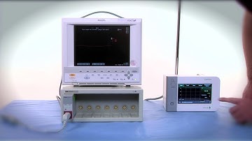 CAM 2 - Overview of the Camino ICP Monitor