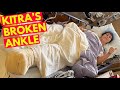 Broken Ankle On A Cruise!