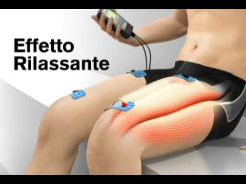 Elettrostimolatore costo:una guida completa - Mdm Fisioterapia