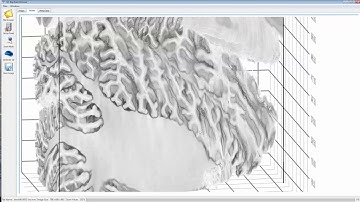 Cerebellum 40 mkm resolution