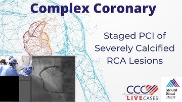 Staged PCI of Severely Calcified RCA Lesions - November 20, 2018