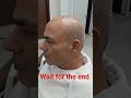 hair patch fixing #hairpatch #hairpatchfixing @AyaanIkram01
