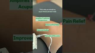 Have Your Heard of ElectroAcupuncture? #electroacupuncture  #acupunctureworks  #chiropractic