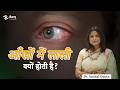 Aankhon mein lali aane ka karan | Red eye causes | Eye Specialist in Delhi #redeye