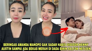 Download Lagu Amanda Manopo Gak Sadar Habis Disosor Kenny Austin, Ada Bekas Merah di DADA Bikin Salfok Netizen MP3 Download Lagu Amanda Manopo Gak Sadar Habis Disosor Kenny Austin, Ada Bekas Merah di DADA Bikin Salfok Netizen MP3