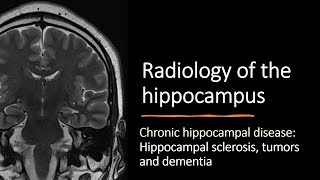 Radiology of the hippocampus  chronic hippocampal disease