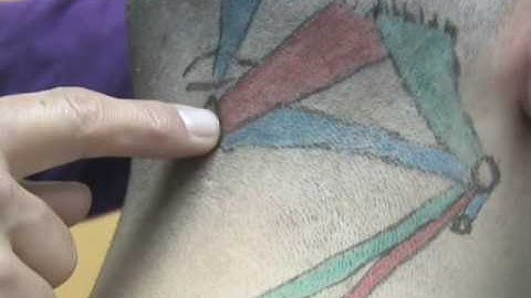 Upper Cervical Muscle Palpation Tutorial