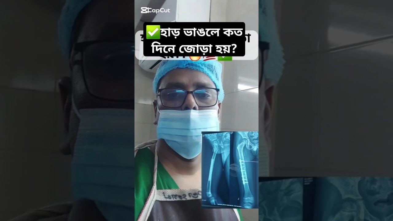 ⁣হাড় ভাঙলে কত দিনে জোড়া হয়| প্লাস্টার কত দিন রাখবেন🔥✅ #fracturerecovery #bonefracture #plaster