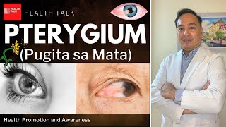 Pterygium (Pugita sa Mata): Causes, Symptoms, Complications, Treatment & Prevention