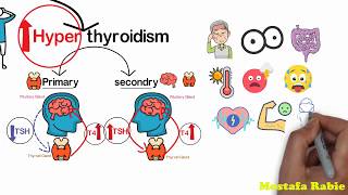 4- الغدة الدرقية وطريقة عملها ووظيفتها والامراض التي تسببها واعرضها ( Thyroid Gland )